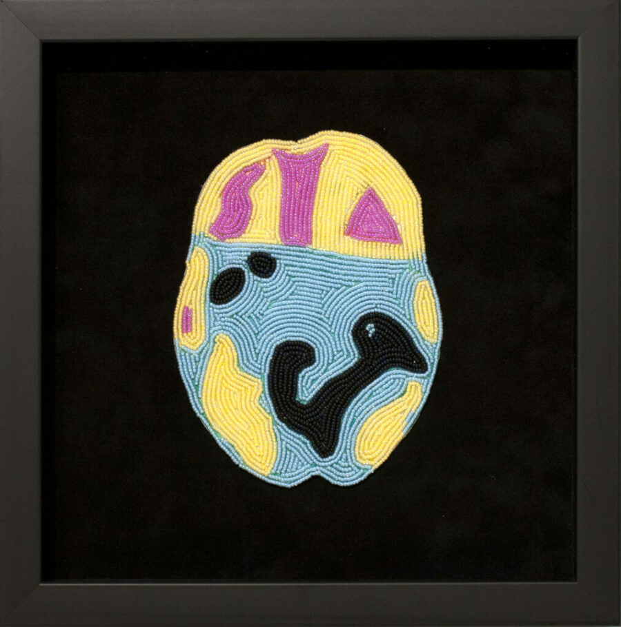 Beaded image of a brain scan in yellow, pink and blue on black cloth.